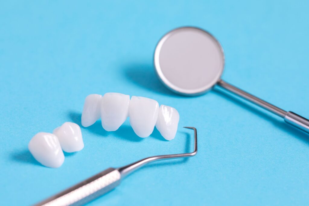 Veneers next to dental mirror on light blue surface